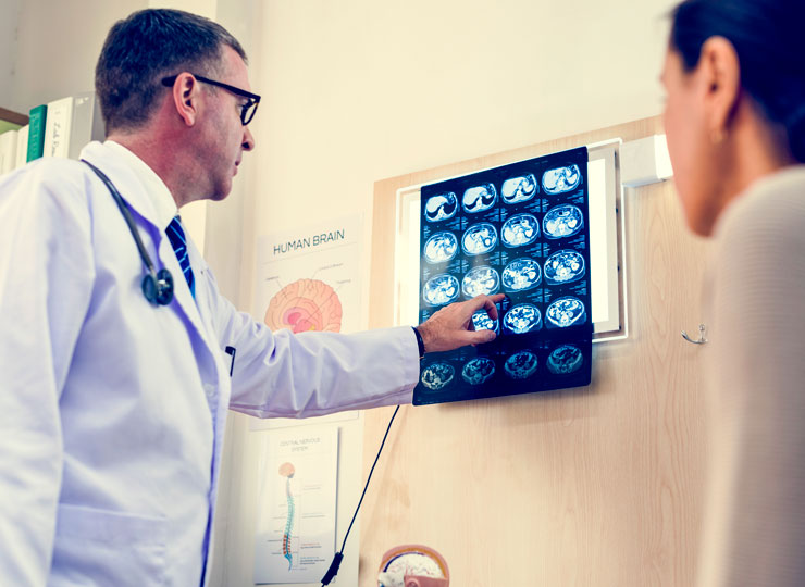 Doctor showing Alzheimer's Brain Scans