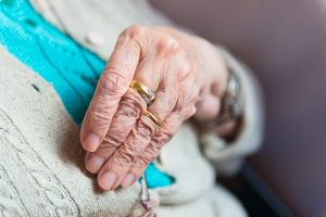 Elderly Alzheimer's Hands Contracture